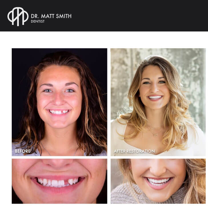 Dr. Matt Smith Dentist - Patient before and after photos