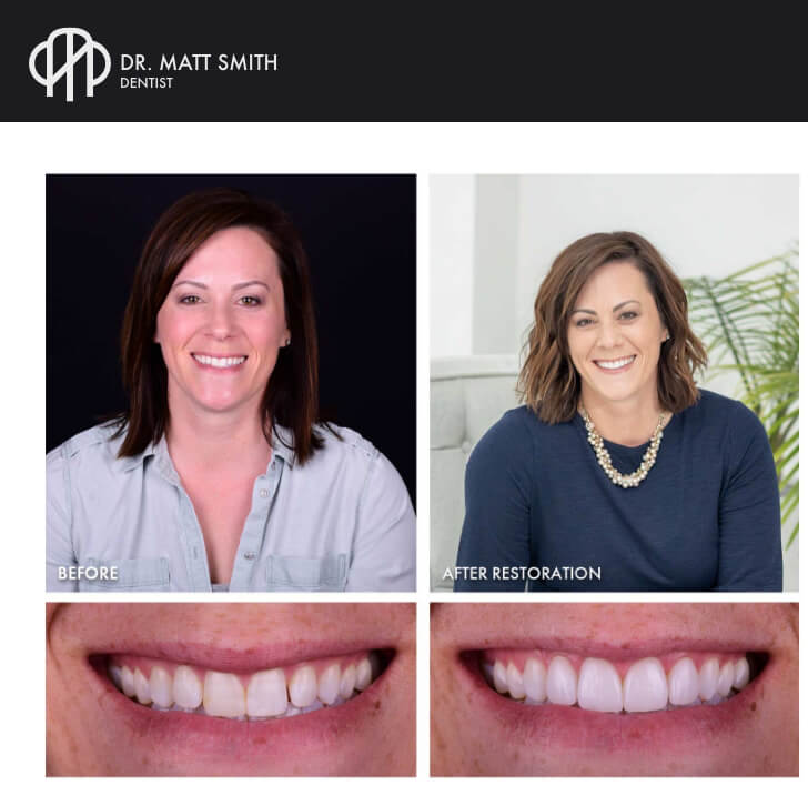 Dr. Matt Smith Dentist - Patient before and after photos